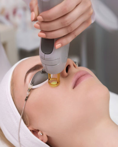 Laser treatments